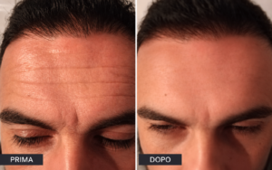 Instatense-prima-dopo-uomo2